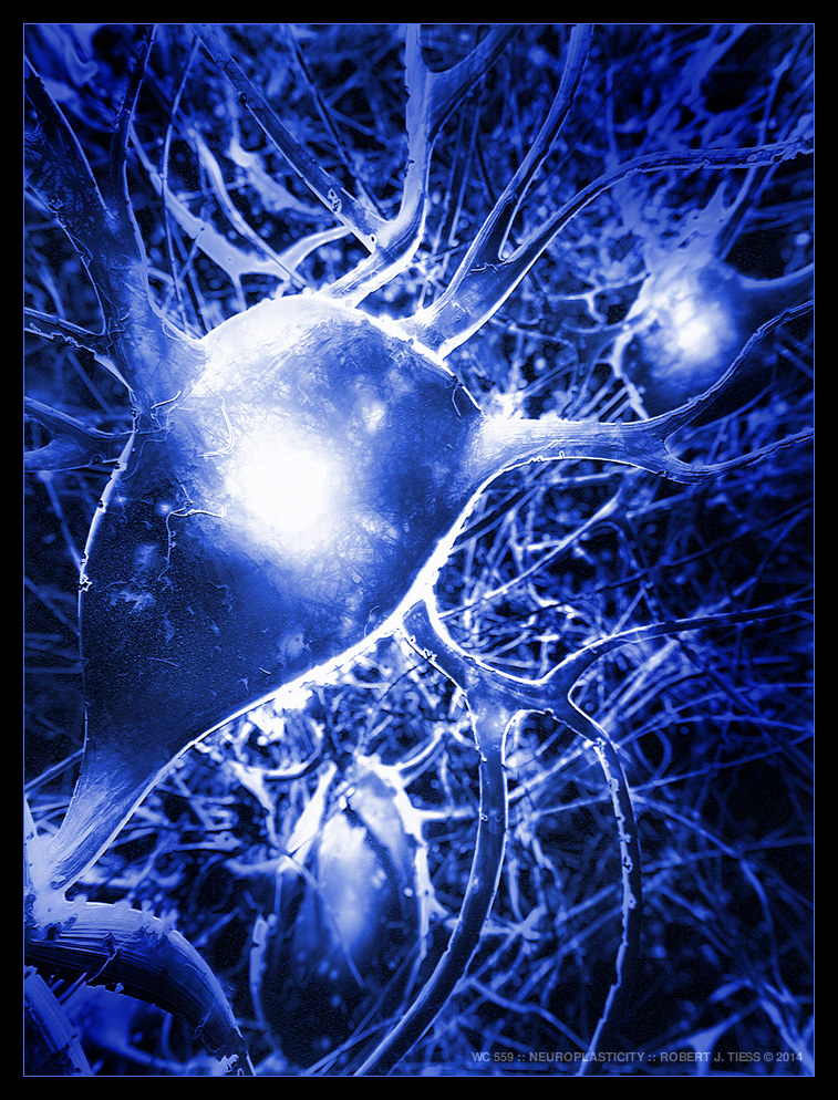 Neuroplasticity - By Robert J. Tiess